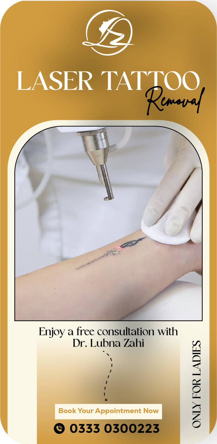 Laser Tattoo Removal in Islamabad