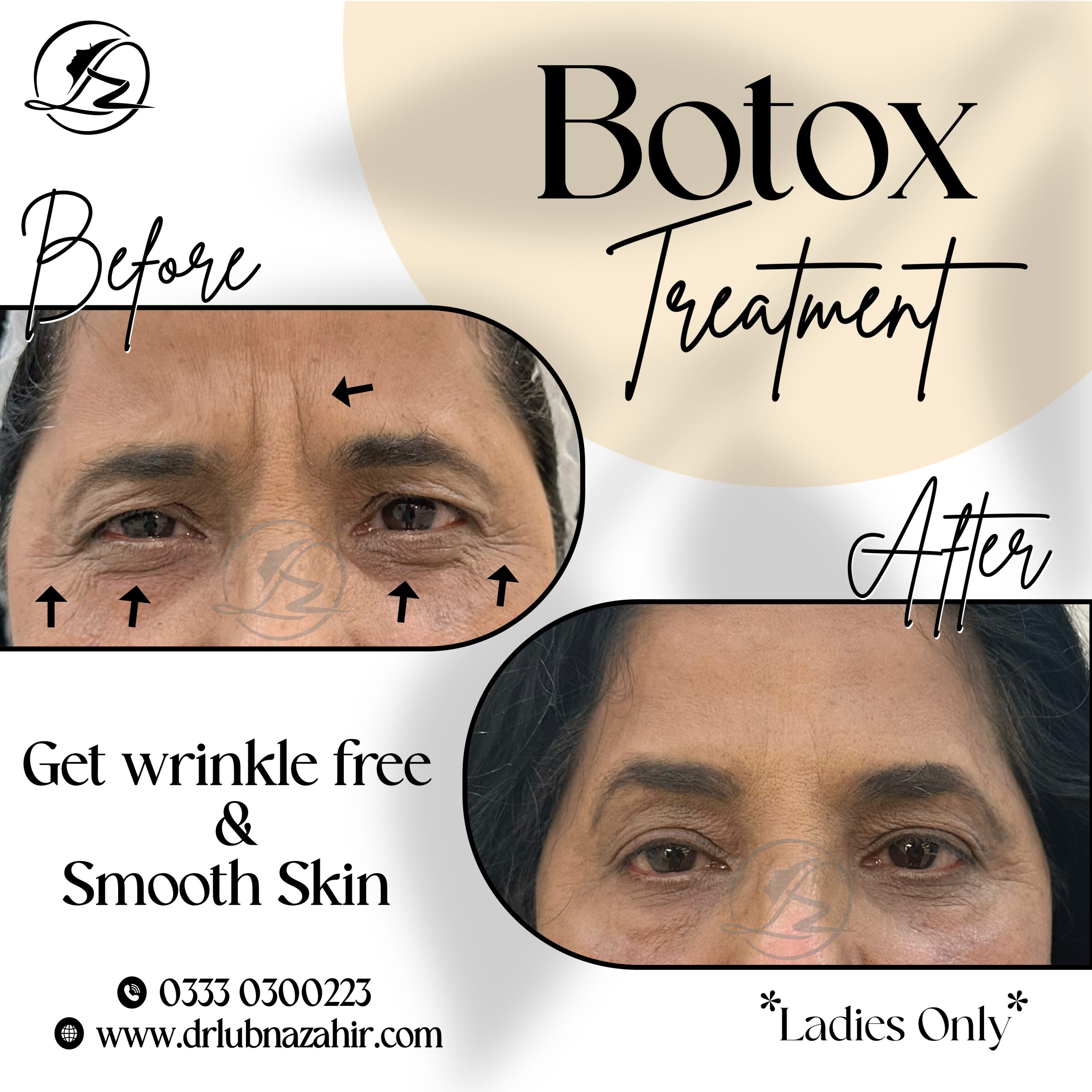 Botox in Islamabad