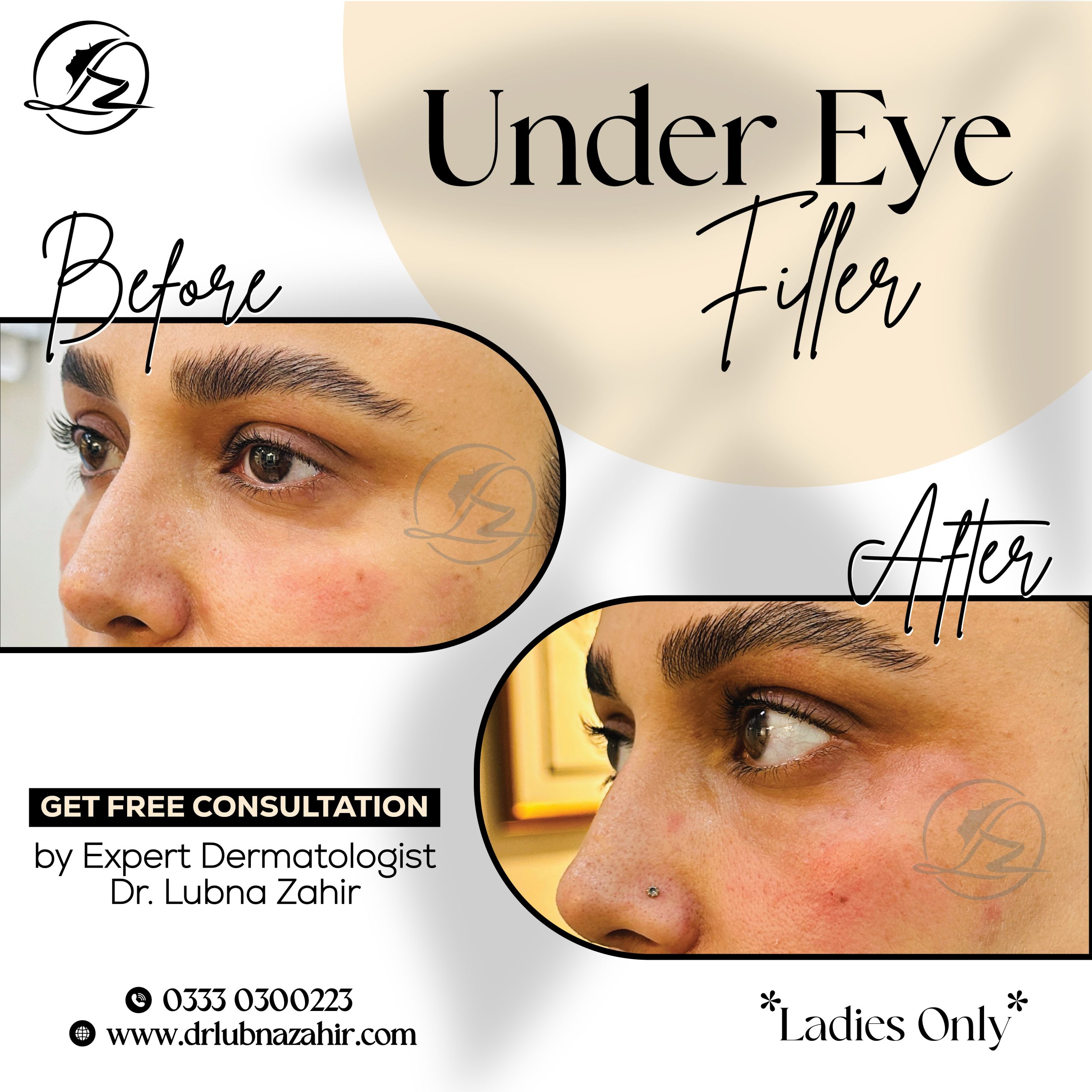 under eye filler in islamabad