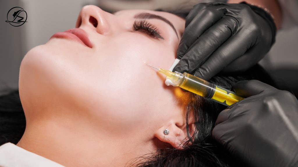 PRP Therapy for Acne Scars