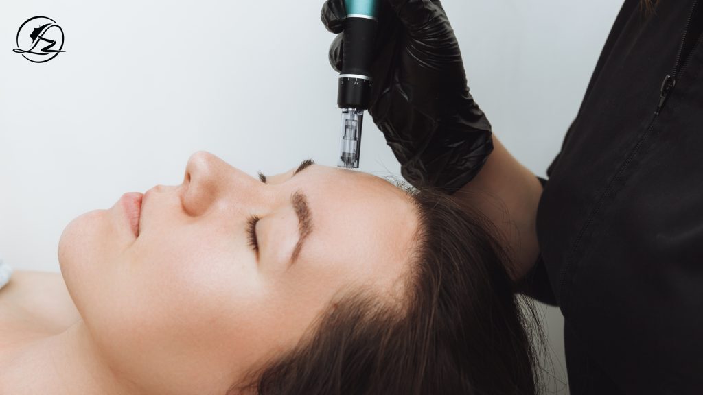 Microneedling in Islamabad