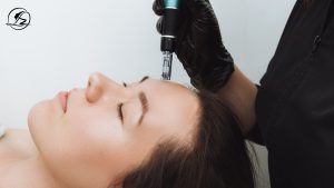 Microneedling in Islamabad