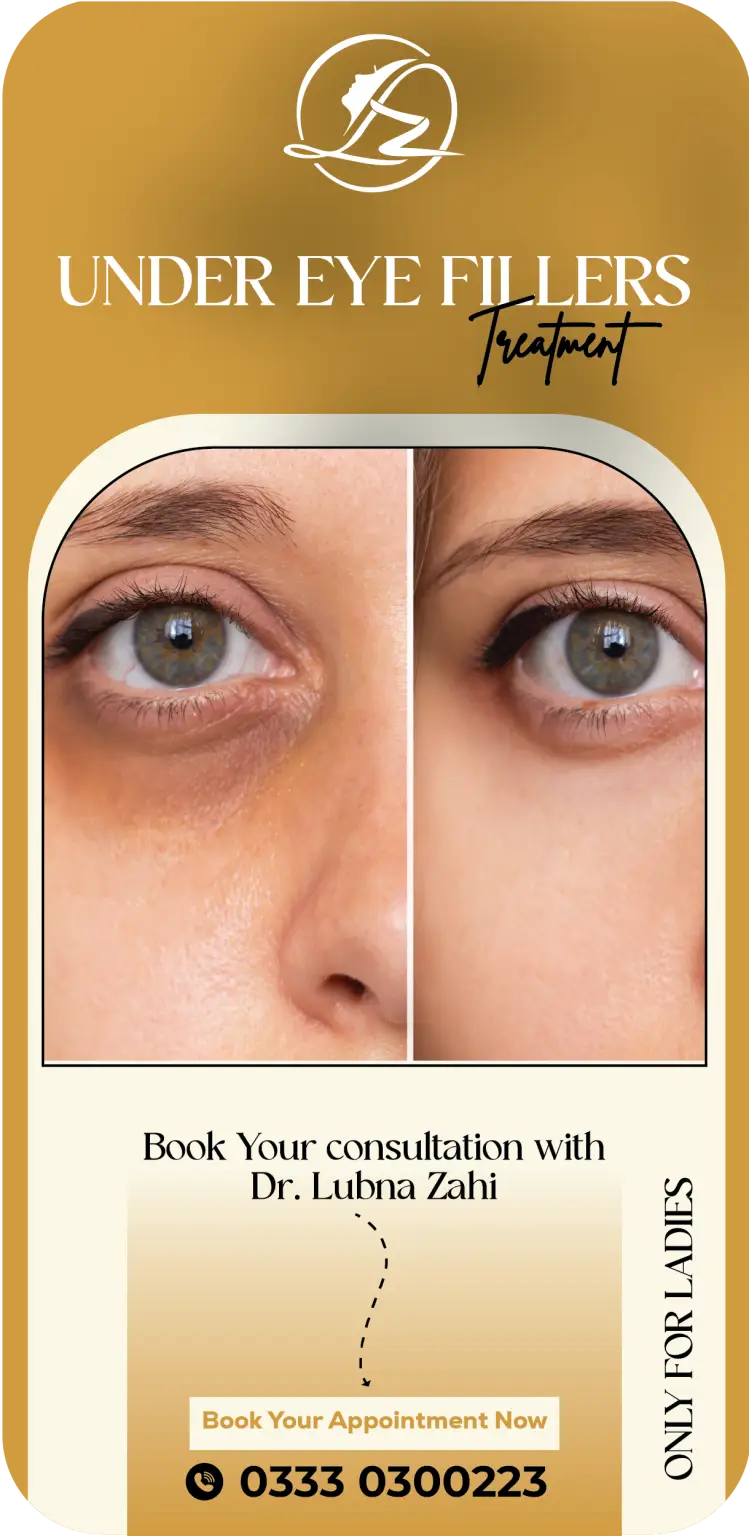 Under Eye Fillers in Islamabad